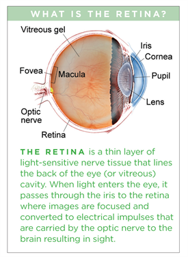 What is the retina?