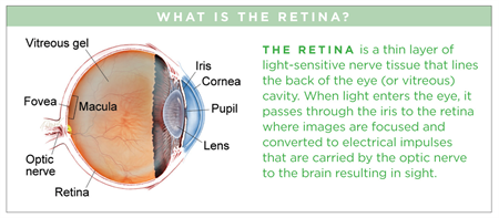 define retina